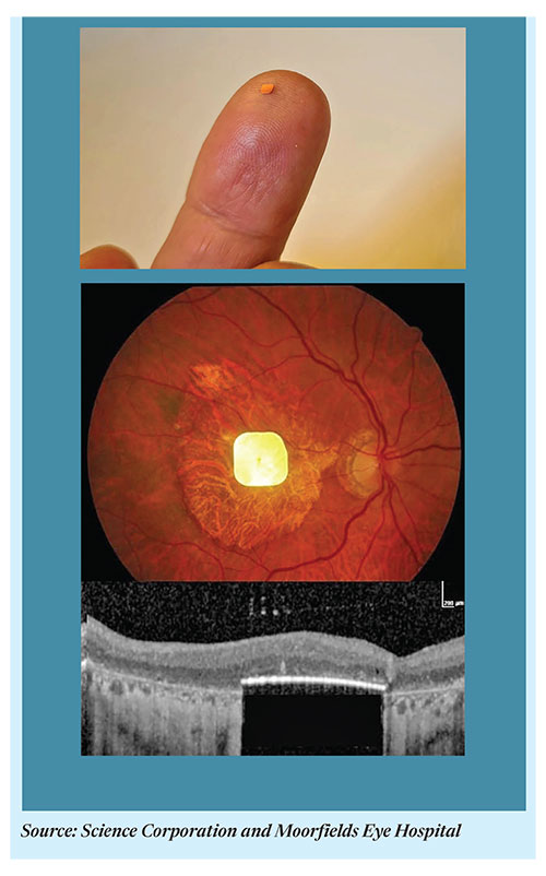  How a British-Bangladeshi surgeon is helping the blind see again